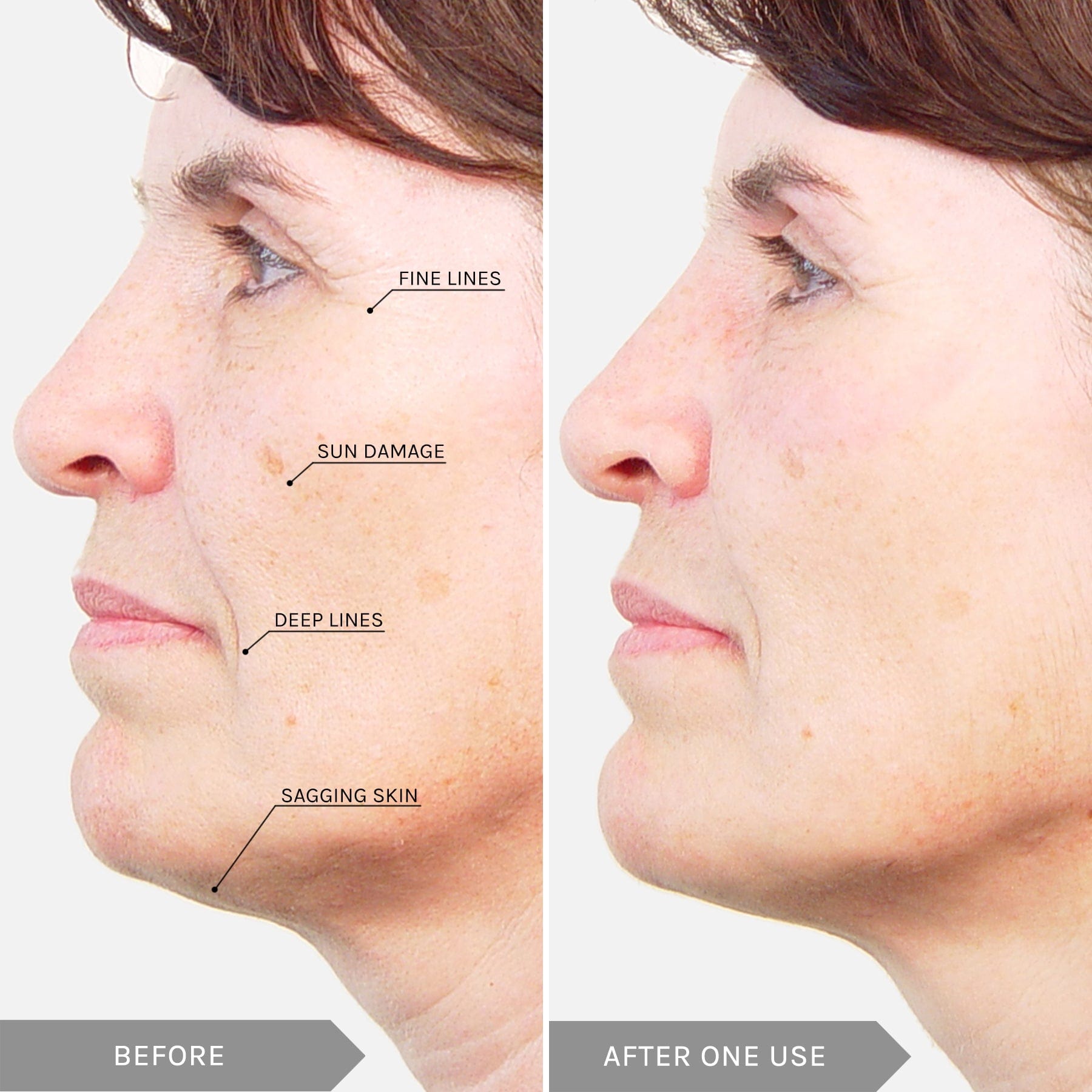Mirenesse ANTIAGEING Power Lift Full-Size Skin Saviours - Express Skin Renew & Anti-Ageing
