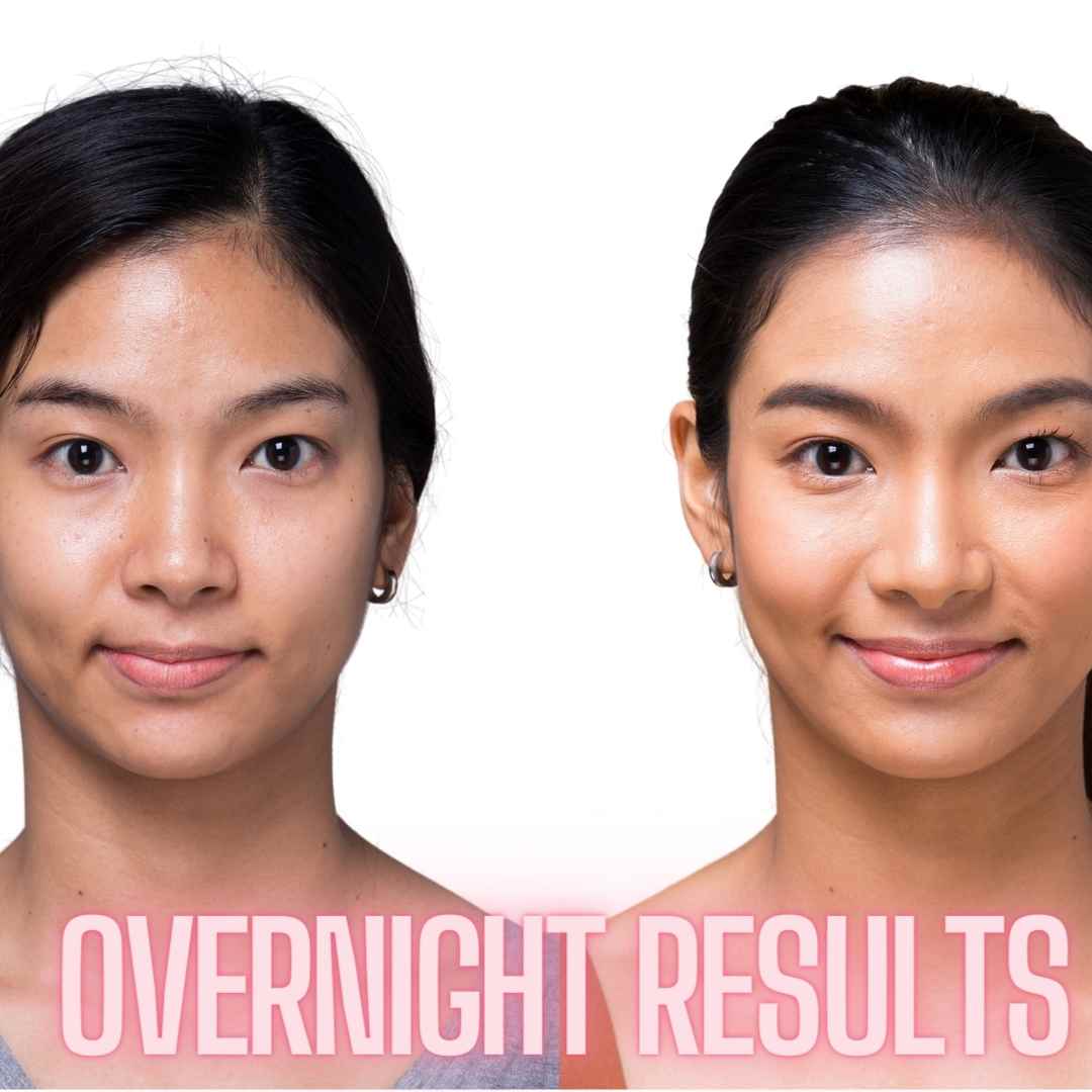 Mirenesse SKINCARE Skin Routine- Fountain Of Youth Glow- Target Deeper LInes Day Night Peel