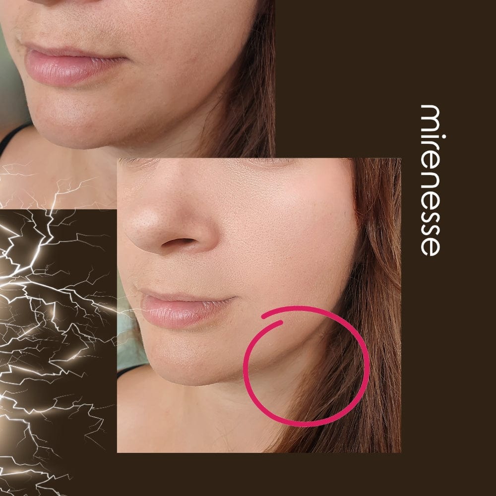 Mirenesse Skincare Power Lift Face Fitness 8 In 1 Microcurrent| Ems Device