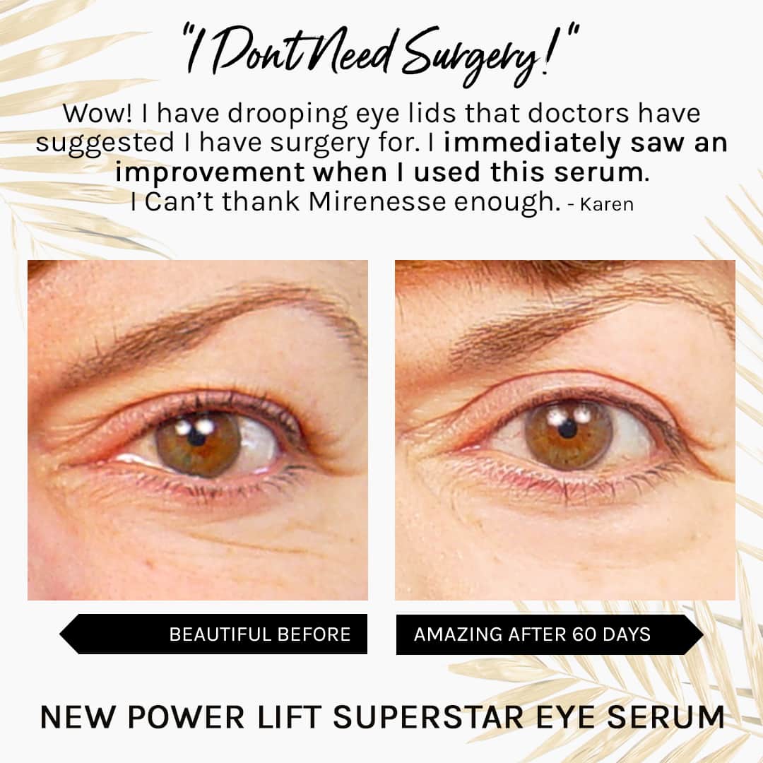 MIRENESSE ANTIAGEING 15g / 0.53oz Winner Best Eye Serum - Superstar Eye Serum with Retinal