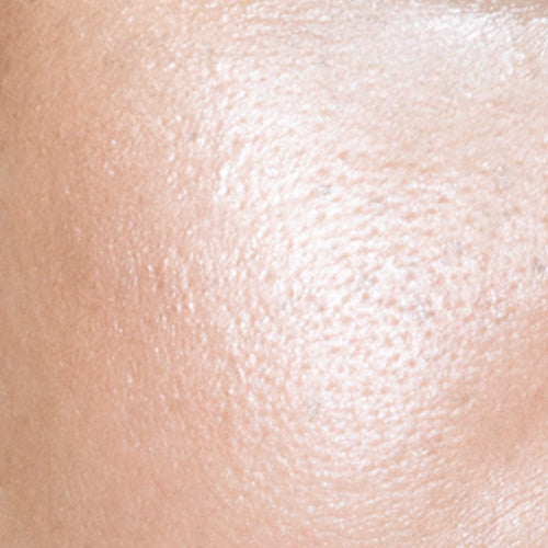 Clogged Large pores