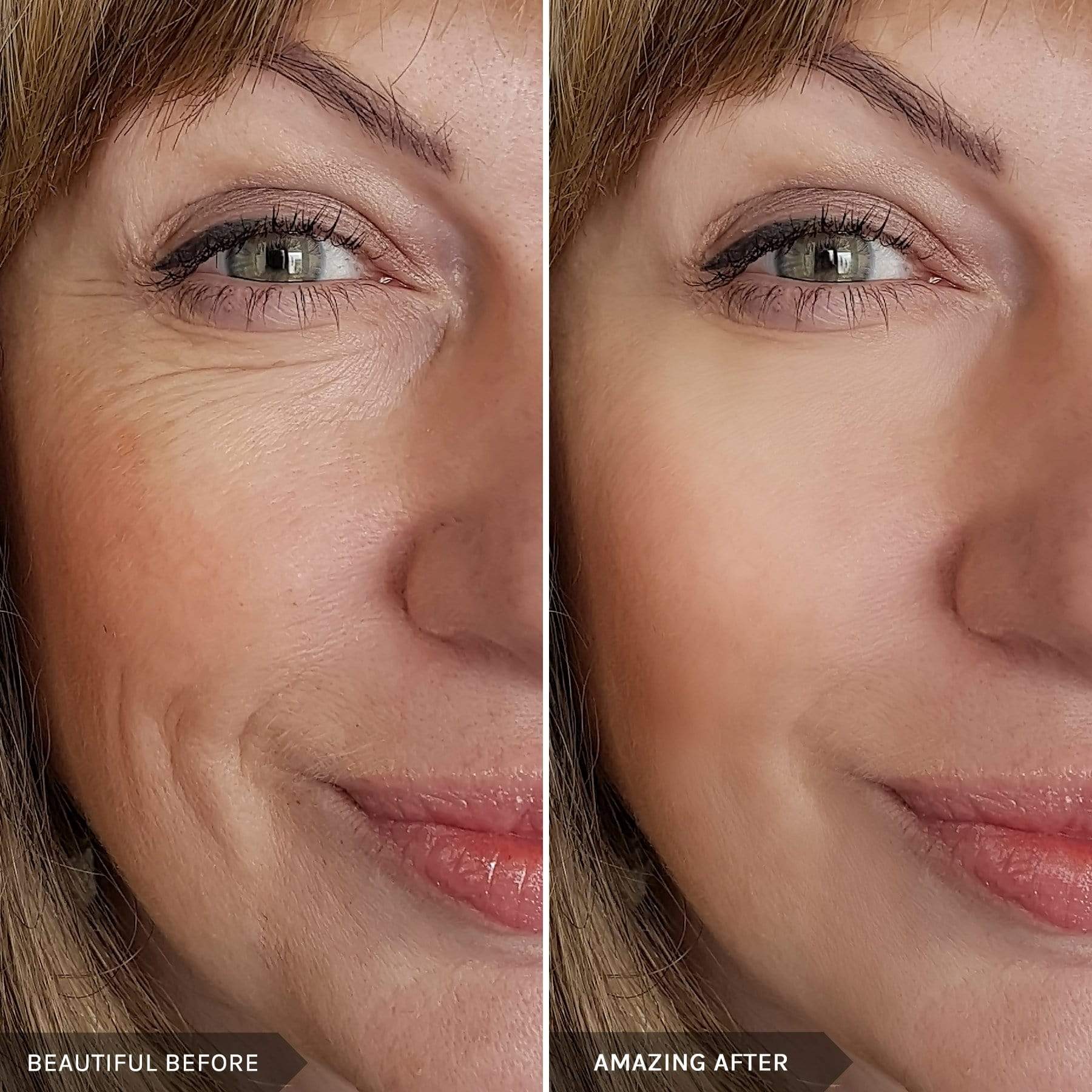 MIRENESSE PACK AON Endless Youth Instant Filler Duo