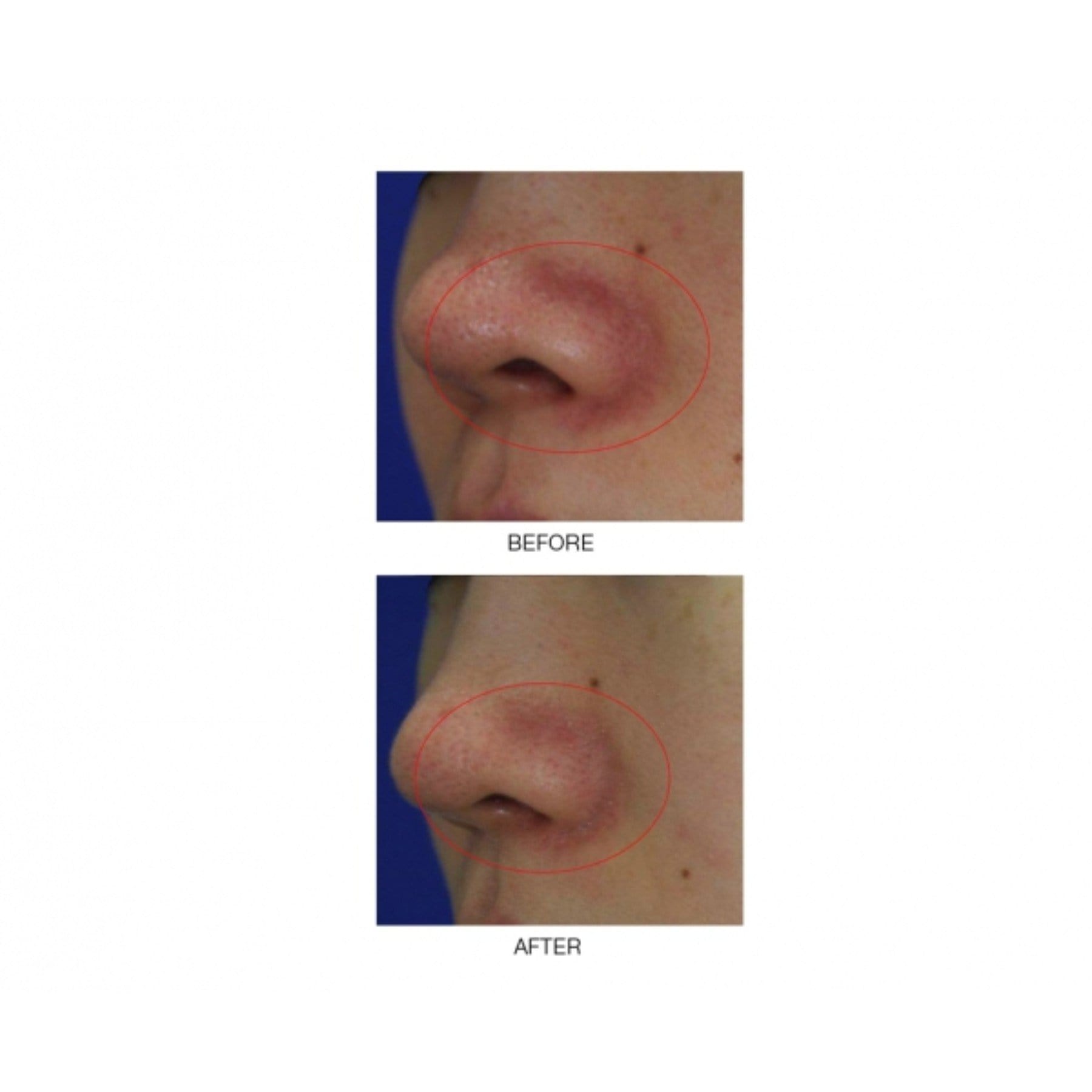 MIRENESSE CLEANSER 10g / 0.35oz Pearly Bubble & Glow Ph Cleanser Mini (US)
