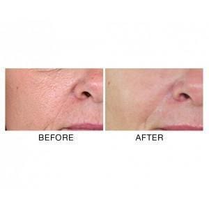 MIRENESSE SKINCARE 10g / 0.35oz Absolute Pores Tightening Serum Mini