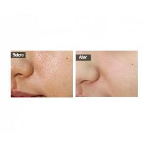 MIRENESSE SKINCARE 10g / 0.35oz Absolute Pores Tightening Serum Mini