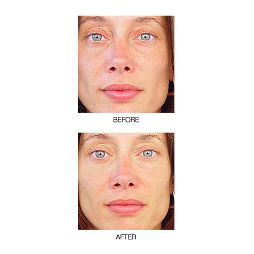 MIRENESSE PACK SKIN Power Lift + Sculpt Collagen Smooth + Boost Tired Skin 4pce