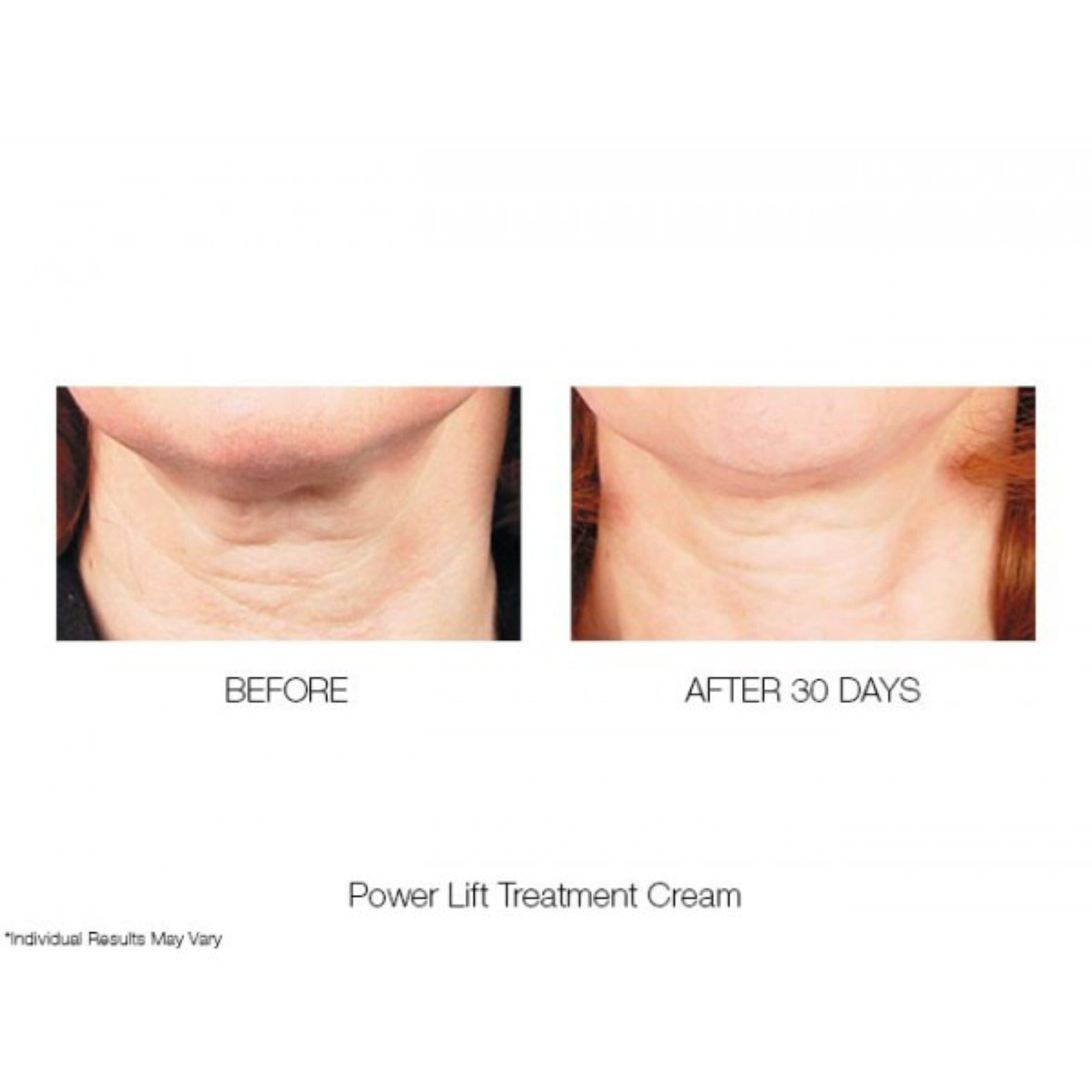 MIRENESSE SKINCARE 60g / 2oz Power Lift Treatment Cream Moisturiser-3 In 1 – Lifts Plumps Firms