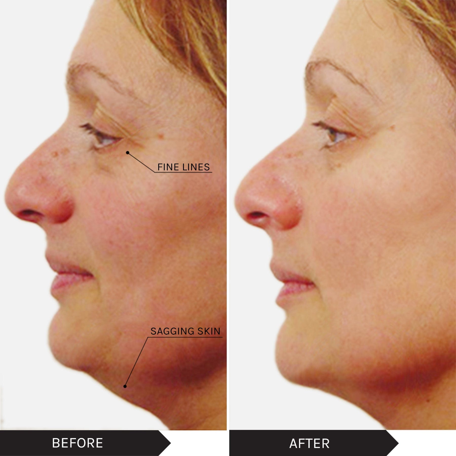 Mirenesse PACK SKIN Power Lift Skin Boosters - Best Sellers 3pce Kit - Vitamin C/Retinol/Collagen