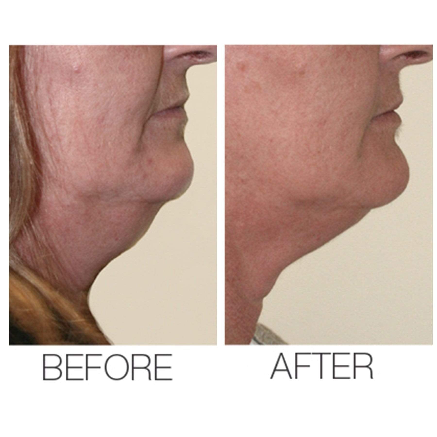 Velvet Maxi Lift Airbrush Foundation + Maxisculpt Collagen Primer  Filler