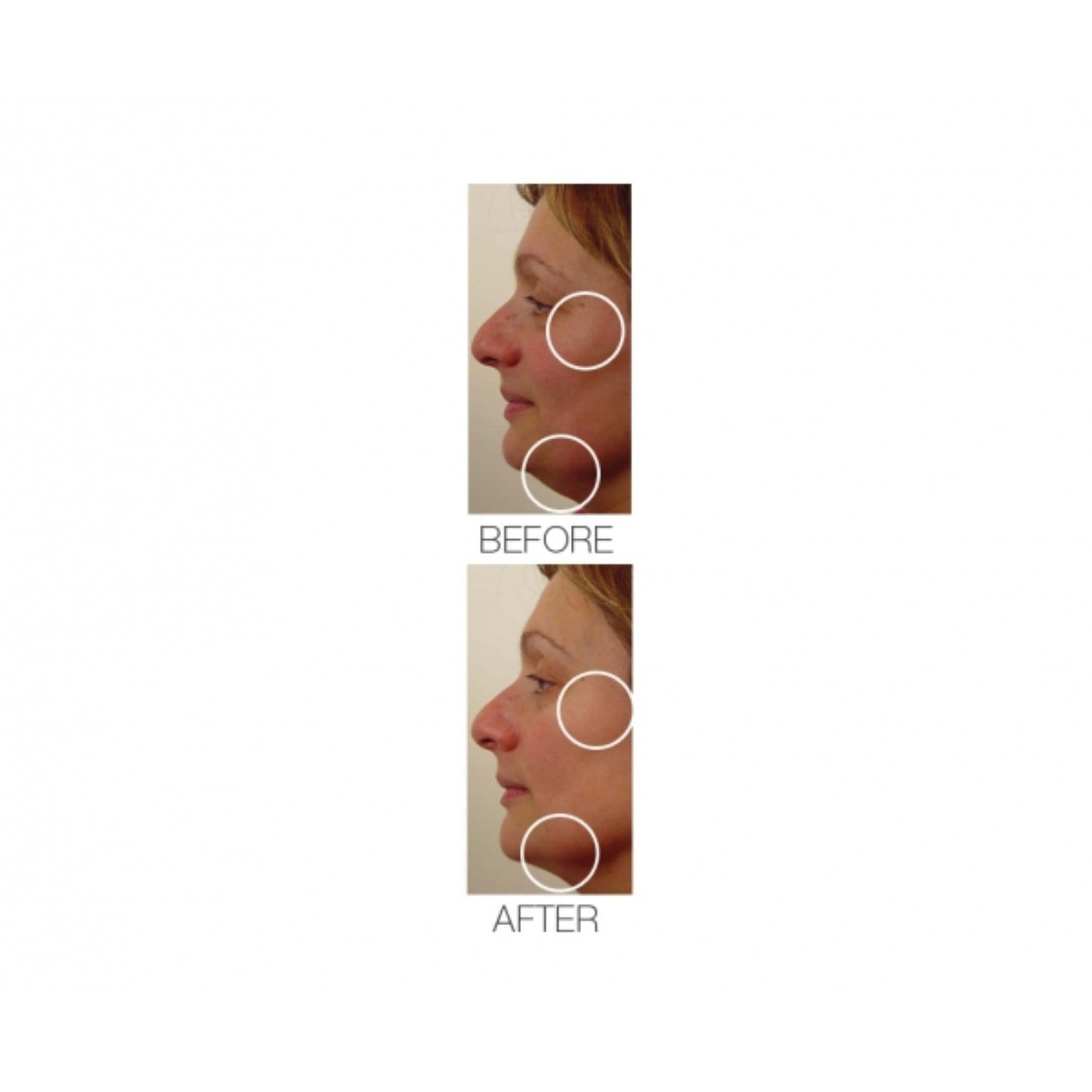 Velvet Maxisculpt V Shape Collagen Gel