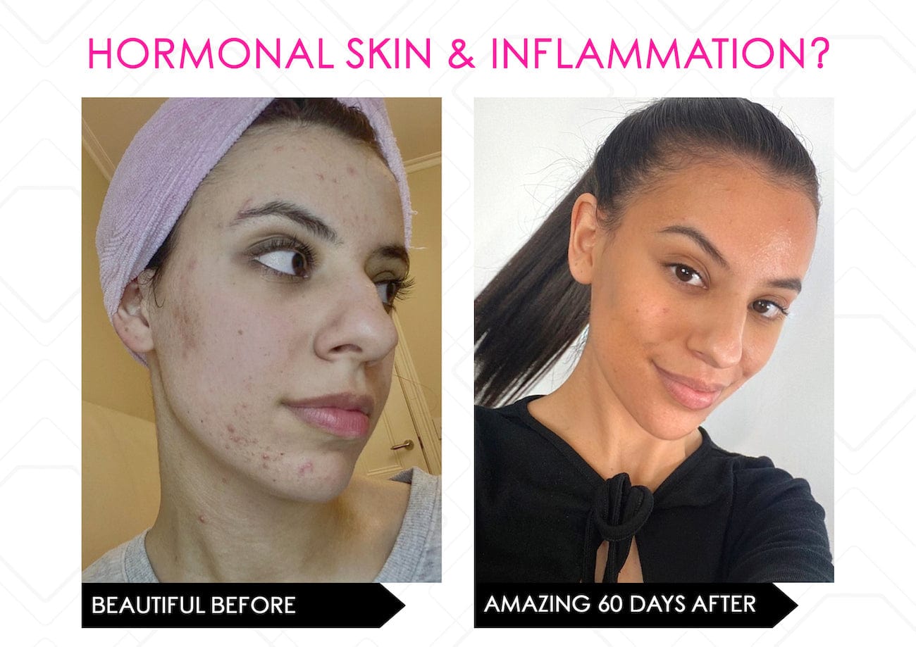 Mirenesse ANTIAGEING Limited Stock* Skin Secrets Pro Kit Amazing LED Mask - Red Led+7 in 1 Treatments FDA Cleared