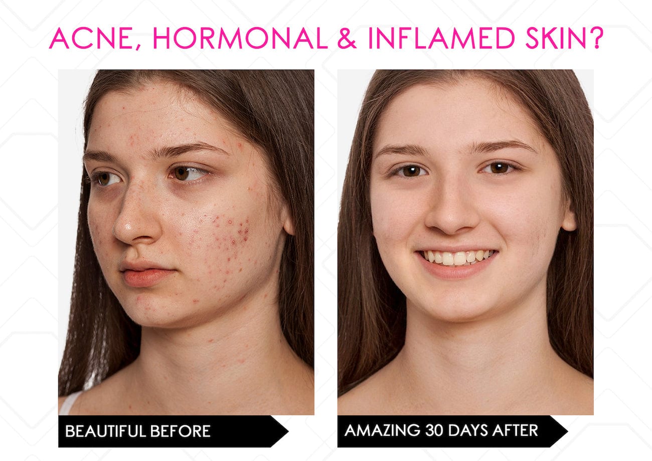Mirenesse ANTIAGEING Limited Stock* Skin Secrets Pro Kit Amazing LED Mask - Red Led+7 in 1 Treatments FDA Cleared