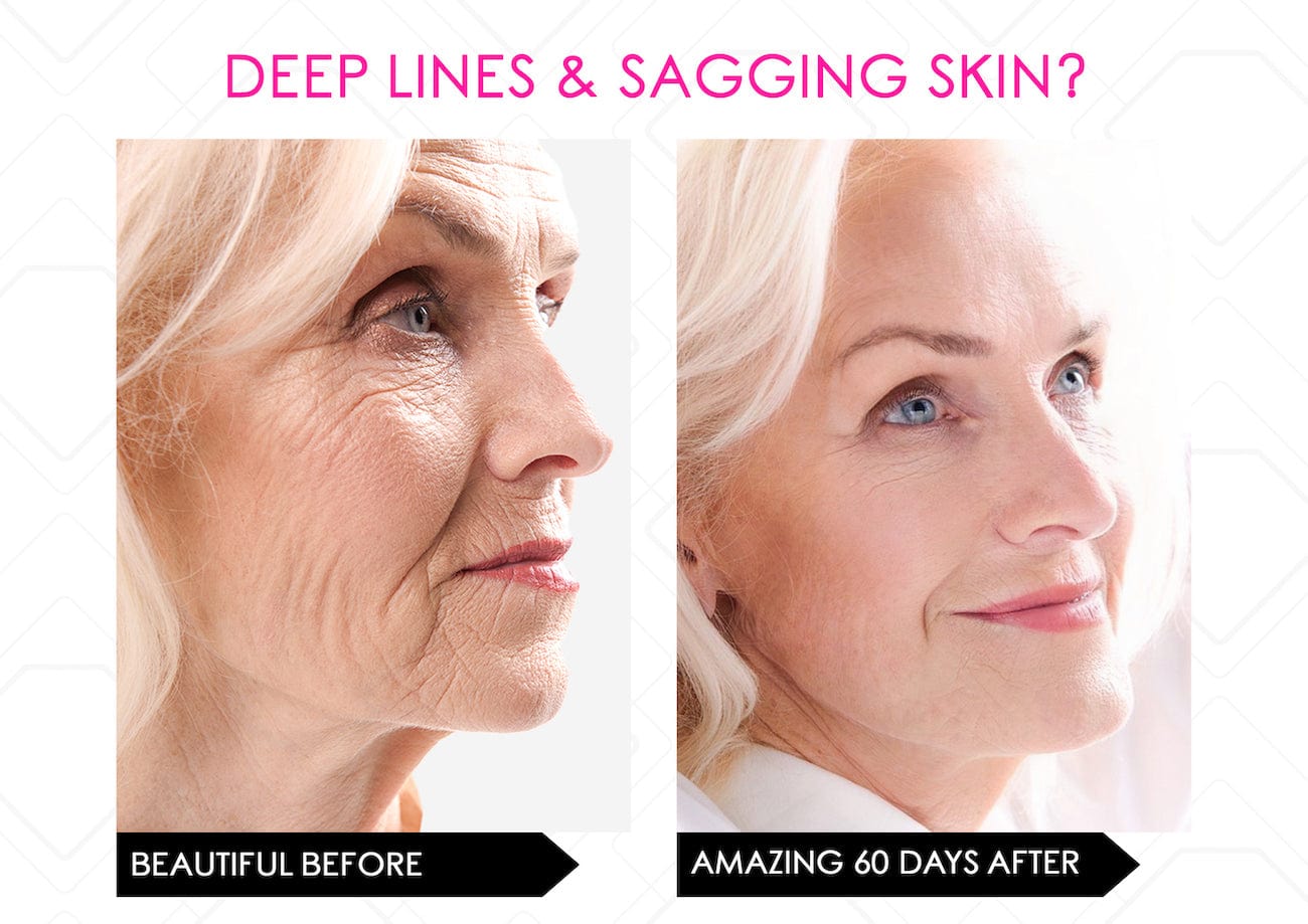 Mirenesse ANTIAGEING Limited Stock* Skin Secrets Pro Kit Amazing LED Mask - Red Led+7 in 1 Treatments FDA Cleared