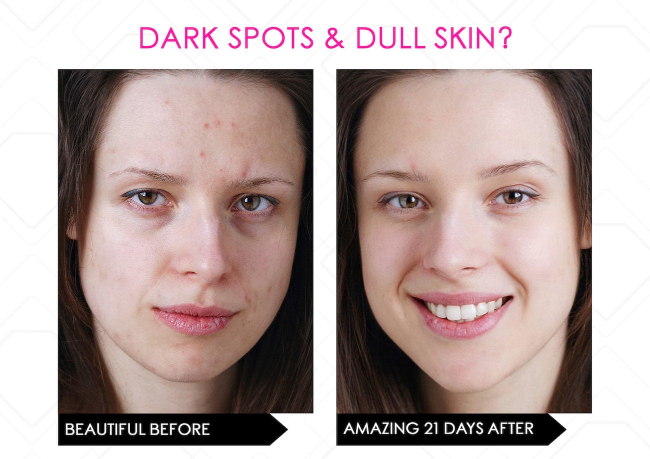 Mirenesse ANTIAGEING Limited Stock* Skin Secrets Pro Kit Amazing LED Mask - Red Led+7 in 1 Treatments FDA Cleared