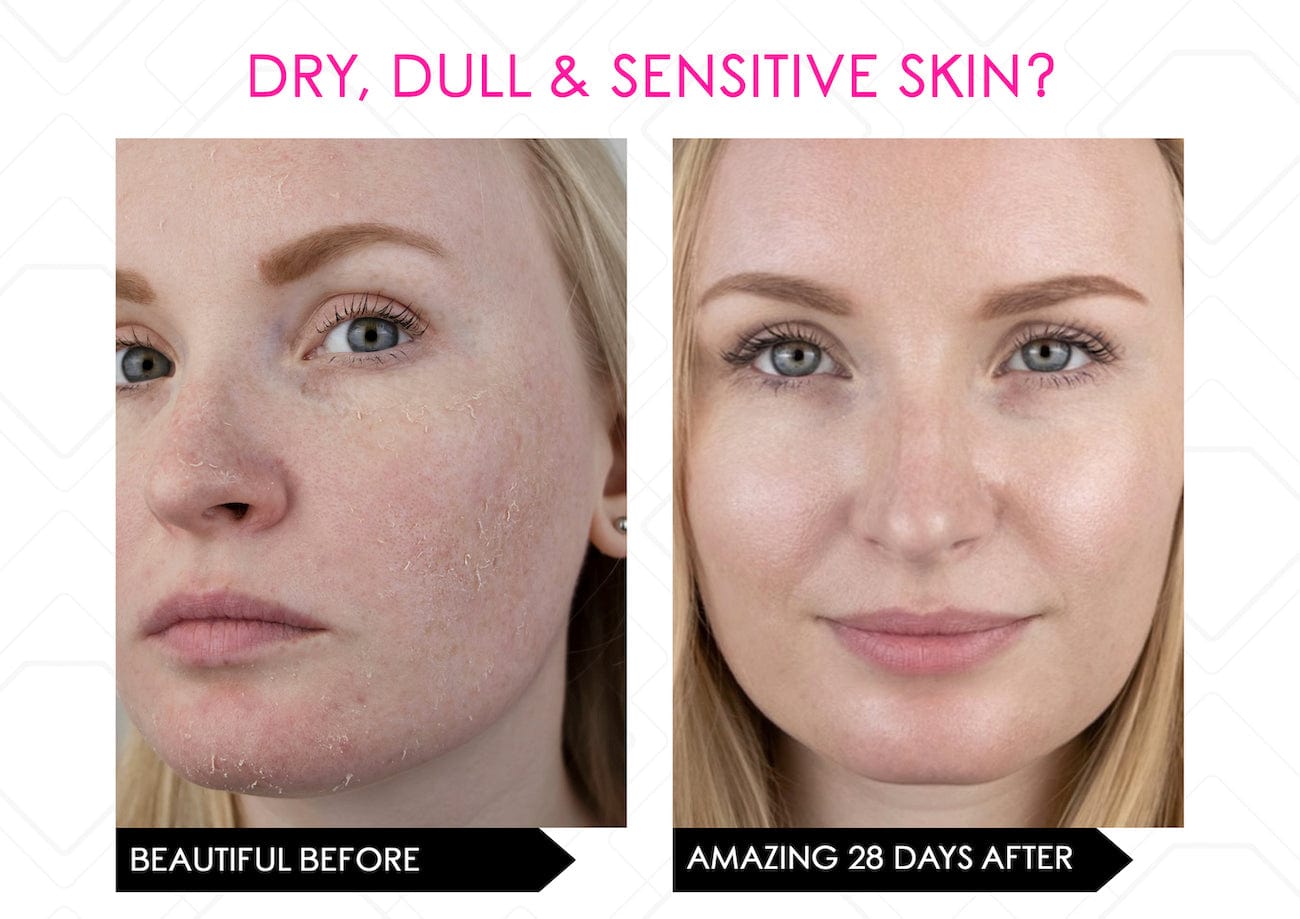 Mirenesse ANTIAGEING Limited Stock* Skin Secrets Pro Kit Amazing LED Mask - Red Led+7 in 1 Treatments FDA Cleared
